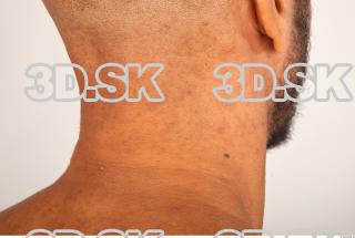 Neck texture of Ron 0006